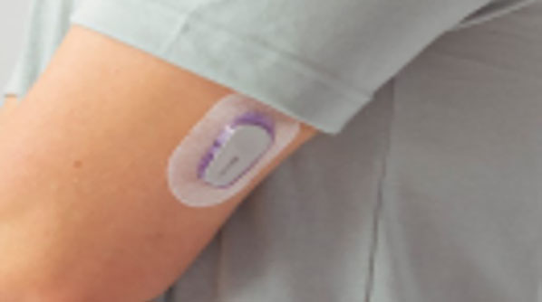 Dexcom CGMs ist bekannt für ihre offenen Schnittstellen CGM zur kontinuierlichen Glukosemessung
